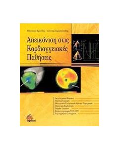 Απεικόνιση στις καρδιαγγειακές παθήσεις
