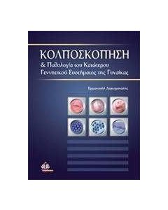 Κολποσκόπηση & παθολογία του κατώτερου γεννητικού συστήματος της γυναίκας